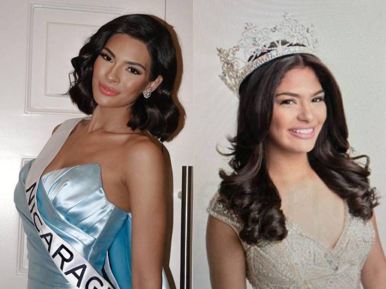 ¿Cuáles son las cirugías plásticas de Miss Universo, Sheynnis Palacios?