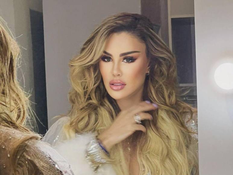 El drástico cambio en el rostro de Ninel Conde