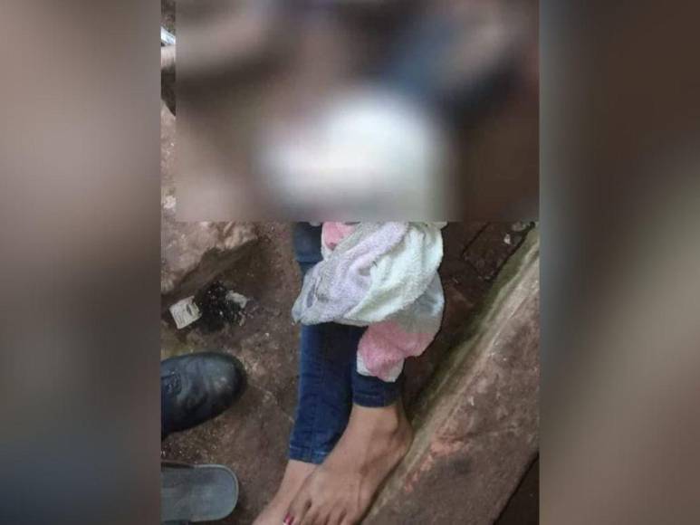 Repudio contra hombre que quemó a expareja: “Psicópata como el diablo”