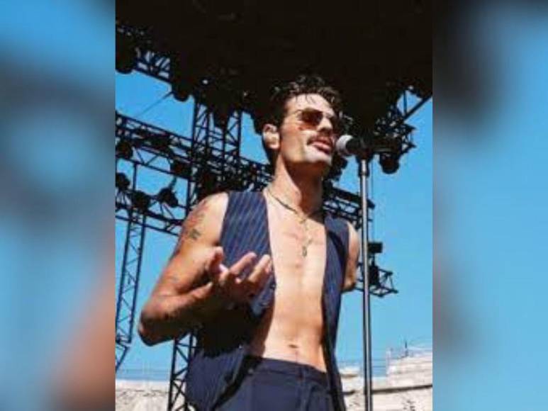 Lucky Love, el cantante francés que sorprende por su parecido con Freddie Mercury