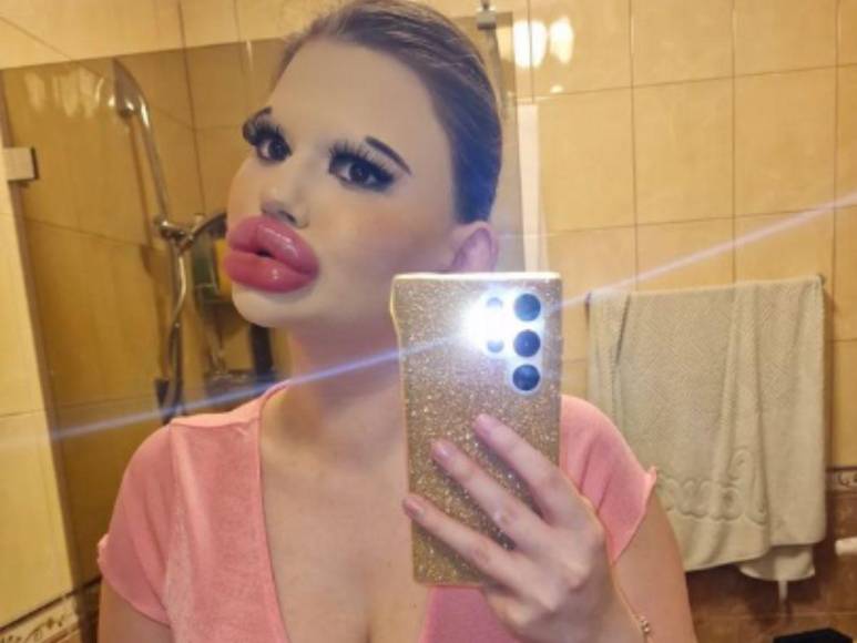 Andrea Ivanova, la mujer con los labios más grandes del mundo