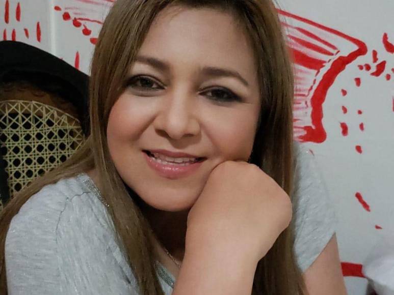 ¿Se operó? El impresionante cambio físico de Marlene Alvarenga con el paso de los años