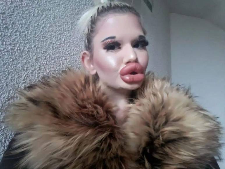 Andrea Ivanova, la mujer con los labios más grandes del mundo