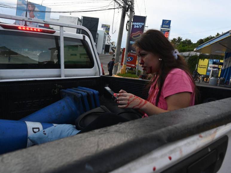 “Me iban a matar, tenían armas y bombas”: Rashid Mejía narra el ataque a manos de colectivos de Libre