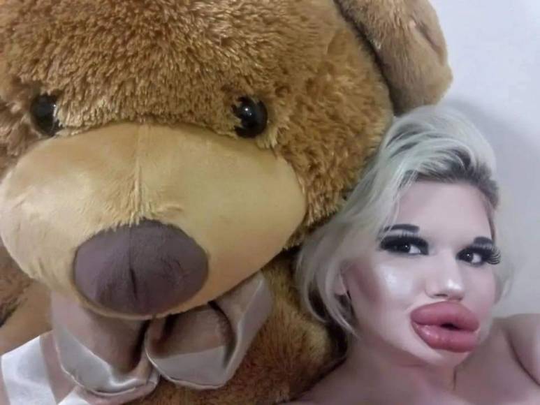 Andrea Ivanova, la mujer con los labios más grandes del mundo