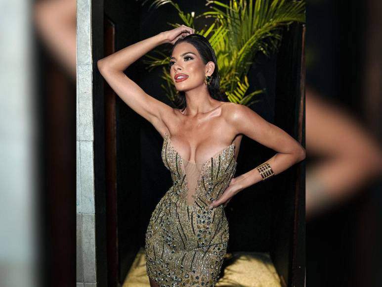 ¿Cuáles son las cirugías plásticas de Miss Universo, Sheynnis Palacios?