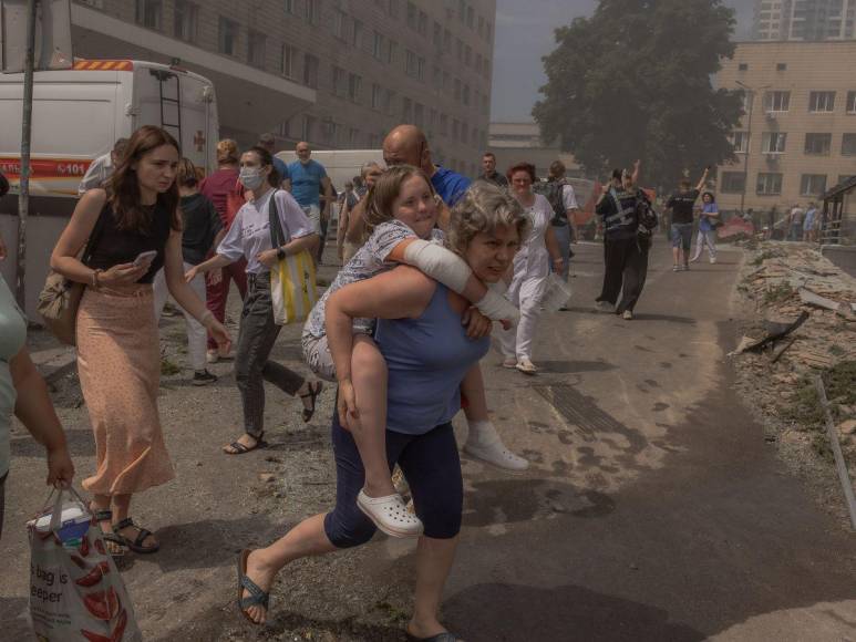 Las fotos más impactantes del bombardeo ruso al Hospital de niños en Kiev, Ucrania