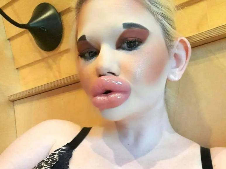 Andrea Ivanova, la mujer con los labios más grandes del mundo