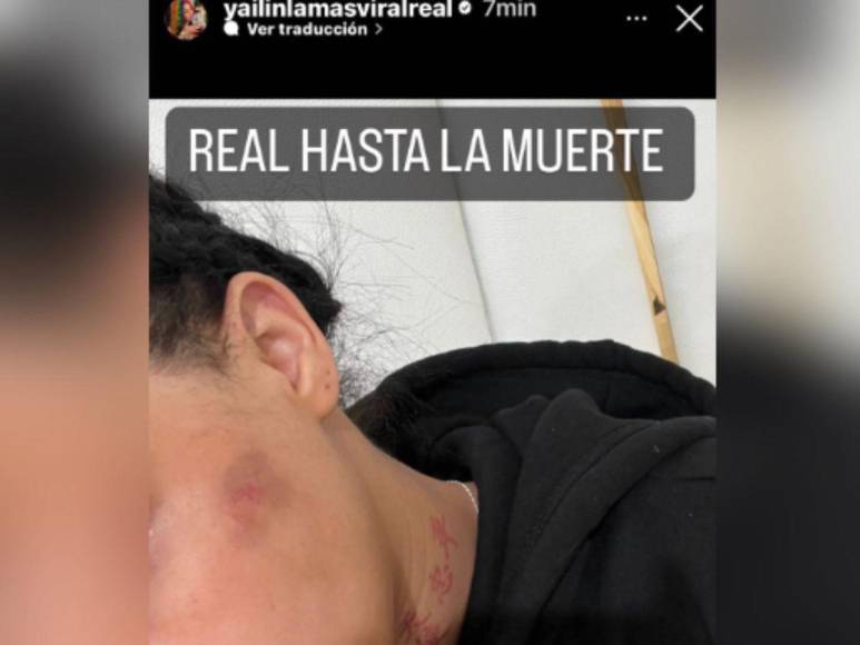 Agresiones y abusos: Anuel AA y Tekashi protagonizan pelea viral por Yailin