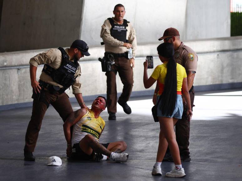 Argentina vs Colombia: varios detenidos por disturbios previo a final de Copa América