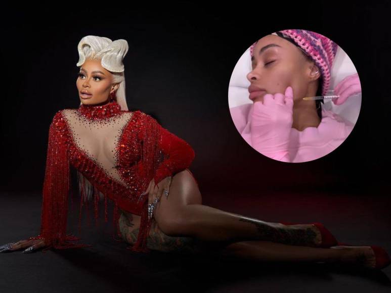 Blac Chyna retira sus implantes de rostro, senos y glúteos