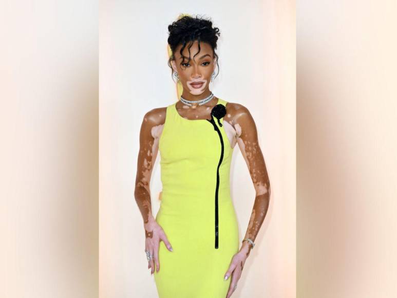 Winnie Harlow impacta con su look en la alfombra champagne de los Oscar