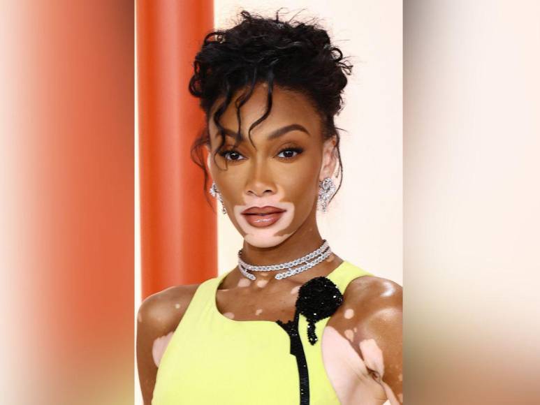 Winnie Harlow impacta con su look en la alfombra champagne de los Oscar