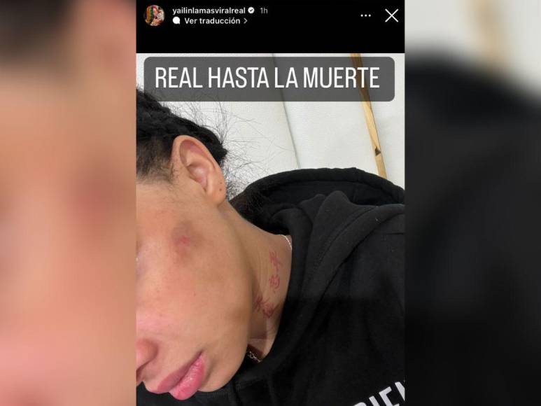 Las señales del posible maltrato que Yailin, ‘La más viral’, sufrió durante su embarazo