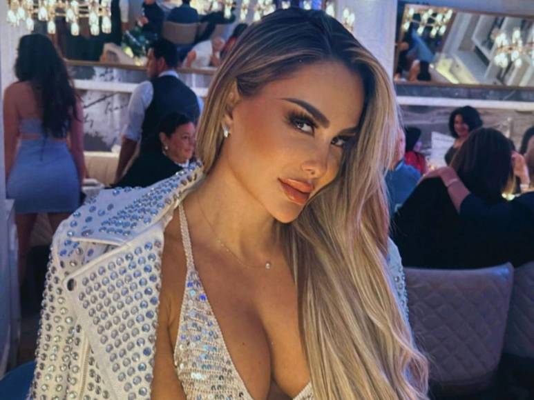 El drástico cambio en el rostro de Ninel Conde