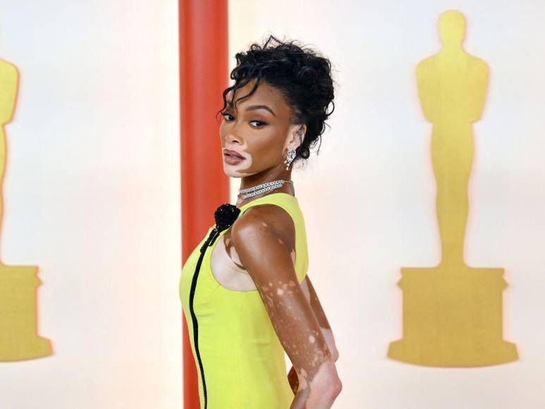 Winnie Harlow impacta con su look en la alfombra champagne de los Oscar