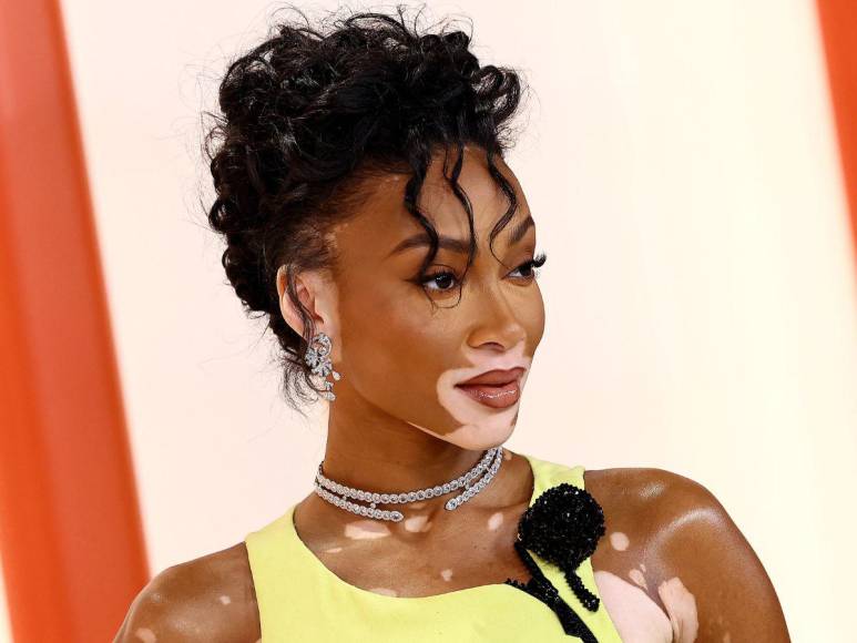 Winnie Harlow impacta con su look en la alfombra champagne de los Oscar