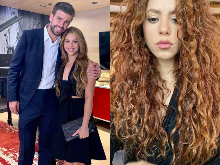 ¿Cuál fue el tratamiento médico al que se sometió Shakira tras su separación con Piqué?