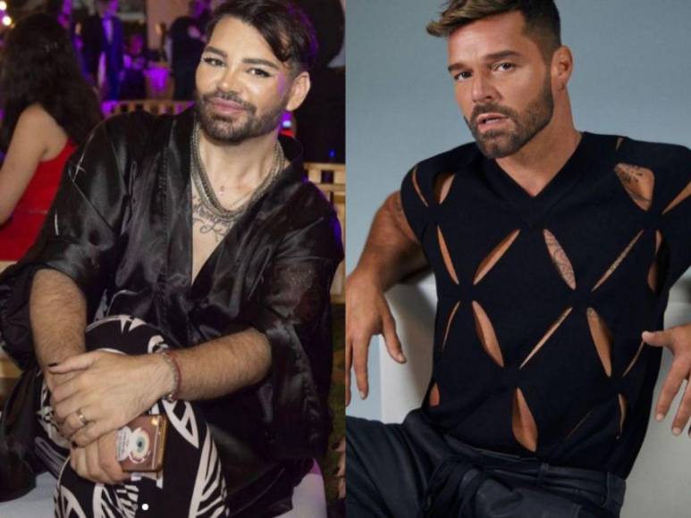 Se hizo más de 30 cirugías para verse como Ricky Martin y ahora hace desesperado pedido