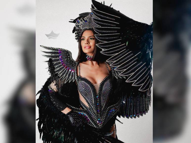 ¿Cuáles son las cirugías plásticas de Miss Universo, Sheynnis Palacios?