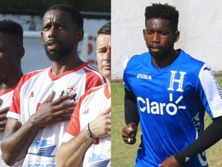 Antes y después de exjugadores que destacaron en el fútbol hondureño