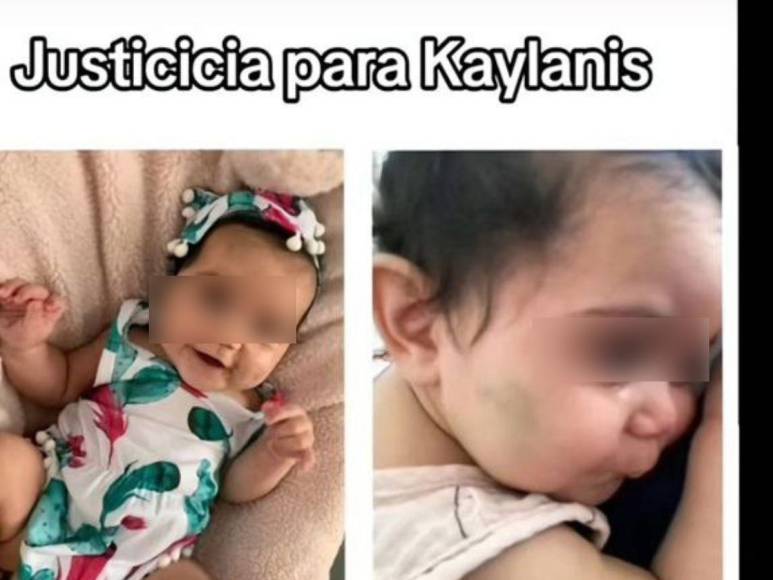 Dijo que hijastra se cayó de la cama, pero llevaba tiempo abusándola