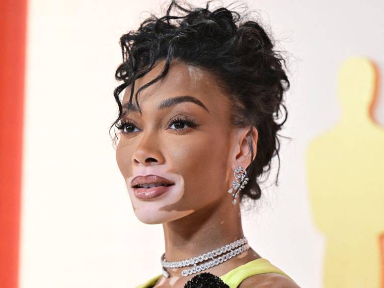 Winnie Harlow impacta con su look en la alfombra champagne de los Oscar