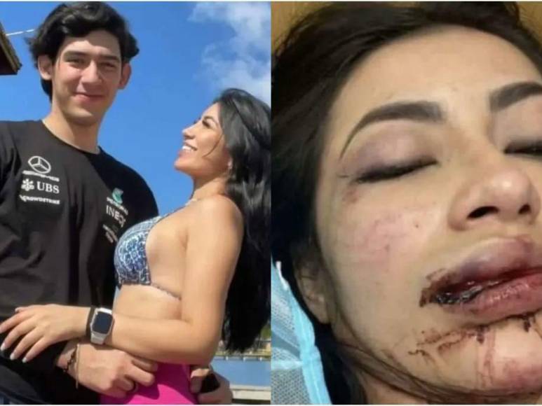 Daniela Aldana vuelve a denunciar a su novio por violencia ¿Está embarazada?