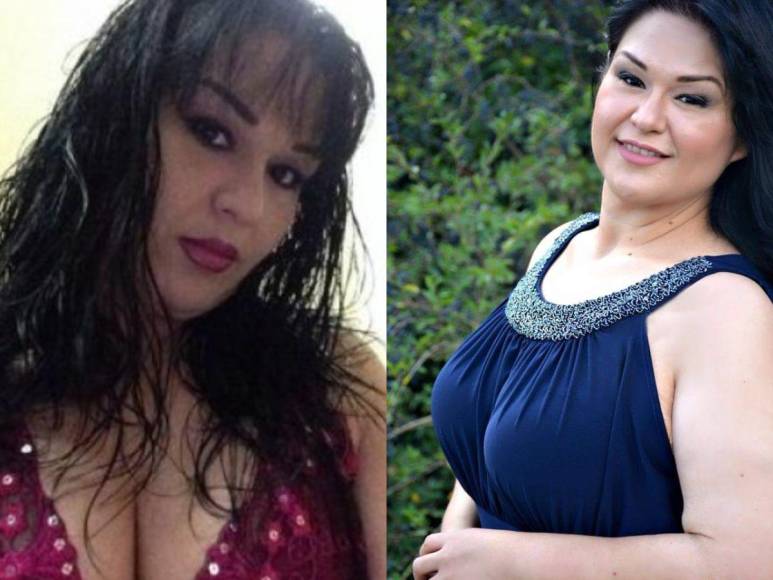 ¿Qué ha sido de Mayra Rosales, “la mujer más obesa del mundo”?