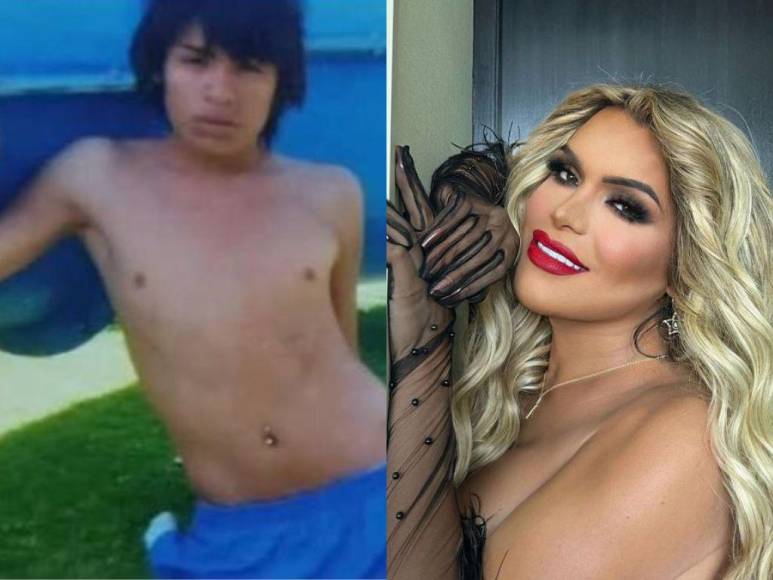 Antes y después: la impresionante transformación de Wendy Guevara tras cirugías estéticas