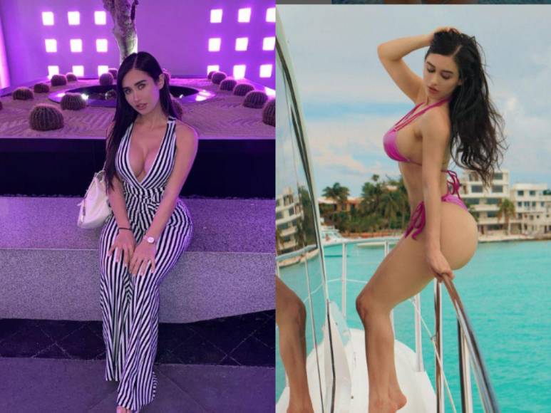 10 modelos e influencers que murieron a causas de las cirugías plásticas