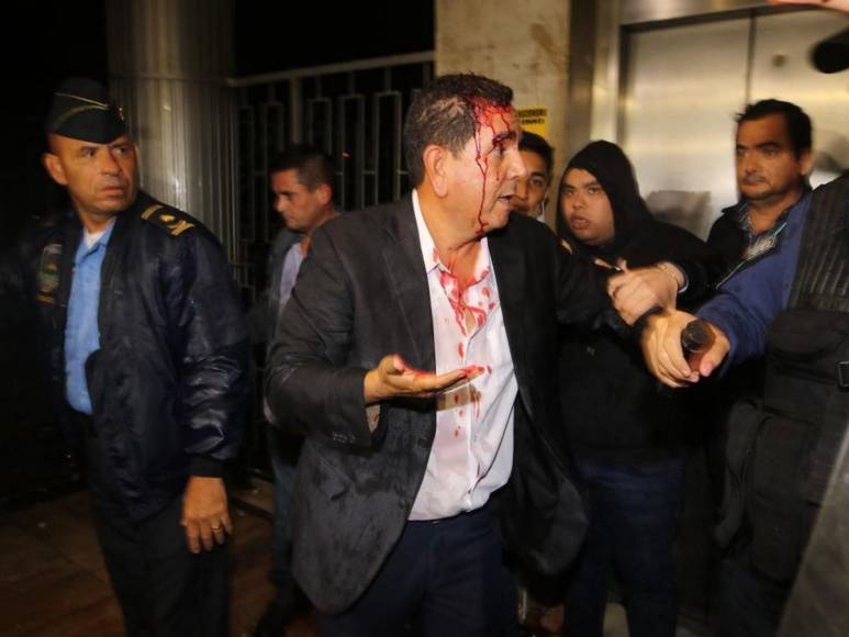 Las 20 fotos que dejó la jornada violenta en el Congreso de Honduras