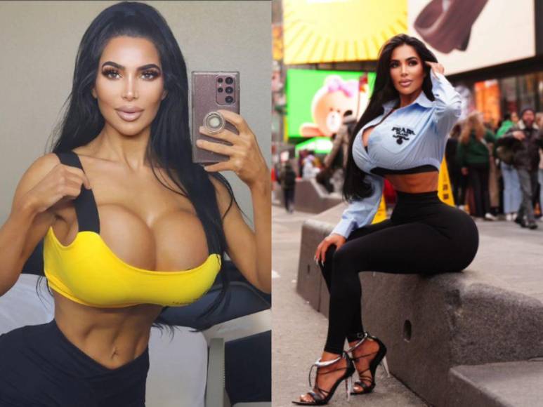 10 modelos e influencers que murieron a causas de las cirugías plásticas