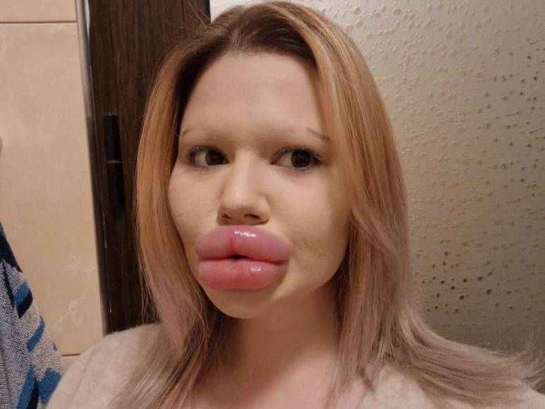 Andrea Ivanova, la mujer con los labios más grandes del mundo