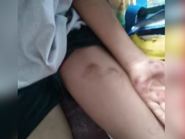 Cuatro niños fueron brutalmente golpeados por sus padres en dos semanas en Honduras