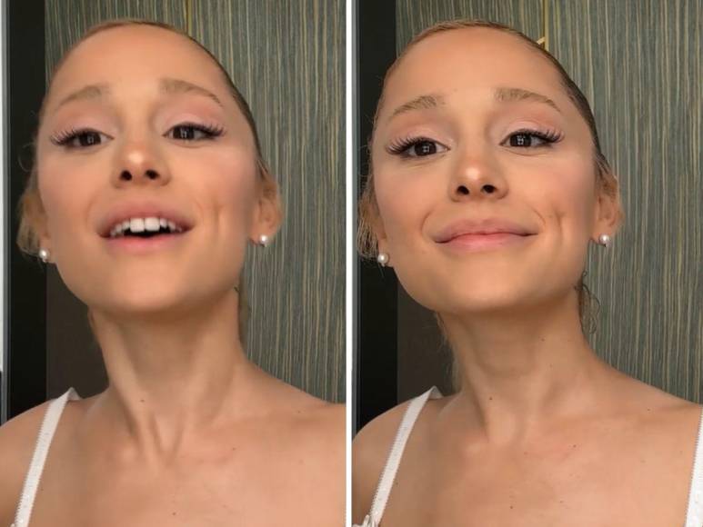 Evolución facial de Ariana Grande: la cantante reconoció haberse inyectado “una tonelada” de relleno de labios y bótox