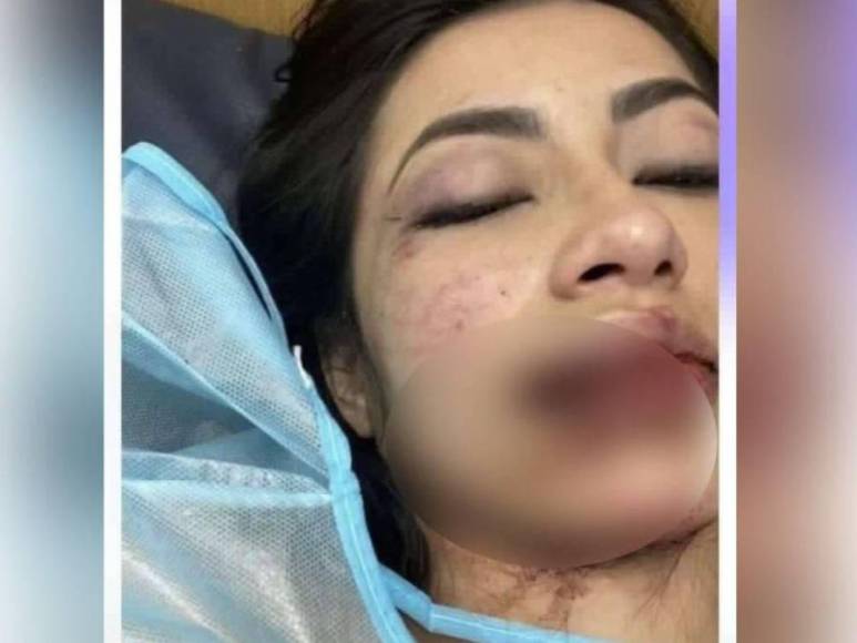 Le entregan silla de ruedas y le ofrecen trasladarse de ciudad: lo último sobre Daniela Aldana, la tiktoker colombiana agredida por su novio en San Pedro Sula