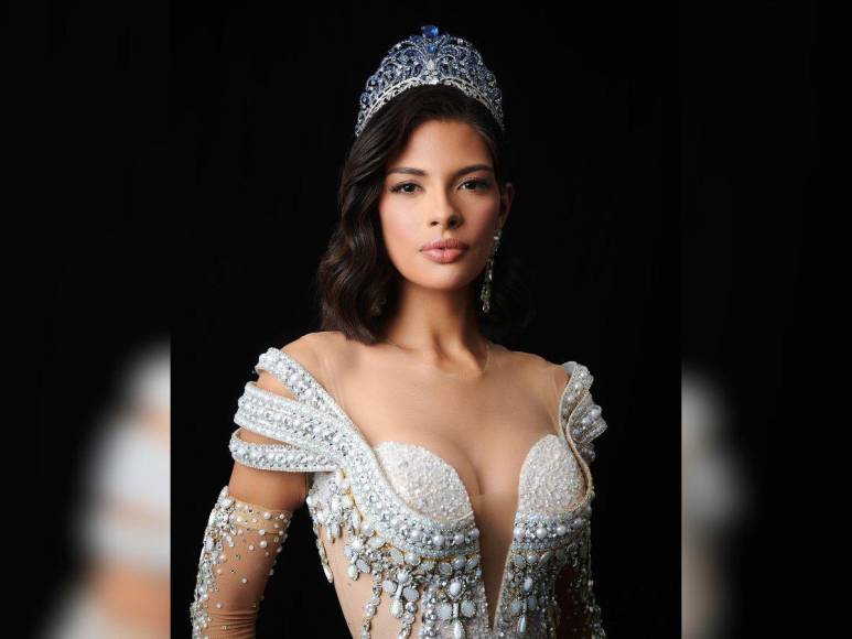 ¿Cuáles son las cirugías plásticas de Miss Universo, Sheynnis Palacios?