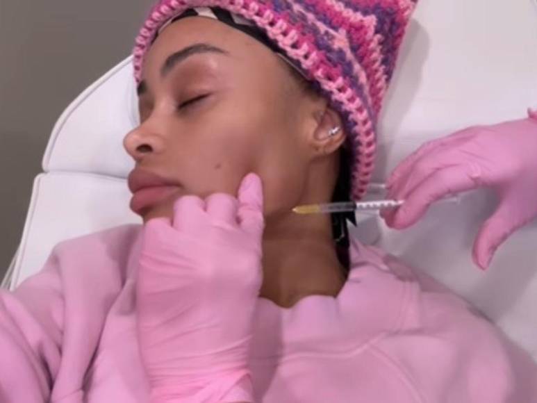 Blac Chyna retira sus implantes de rostro, senos y glúteos