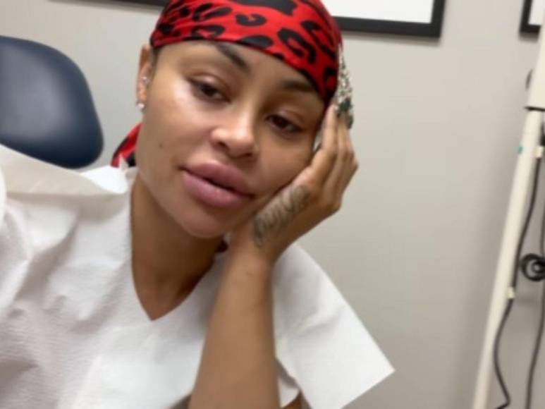 Blac Chyna retira sus implantes de rostro, senos y glúteos