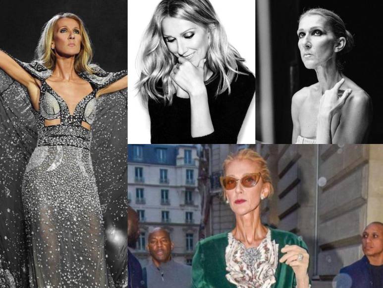 “En espera de un milagro” ante preocupante deterioro de la salud de Celine Dion