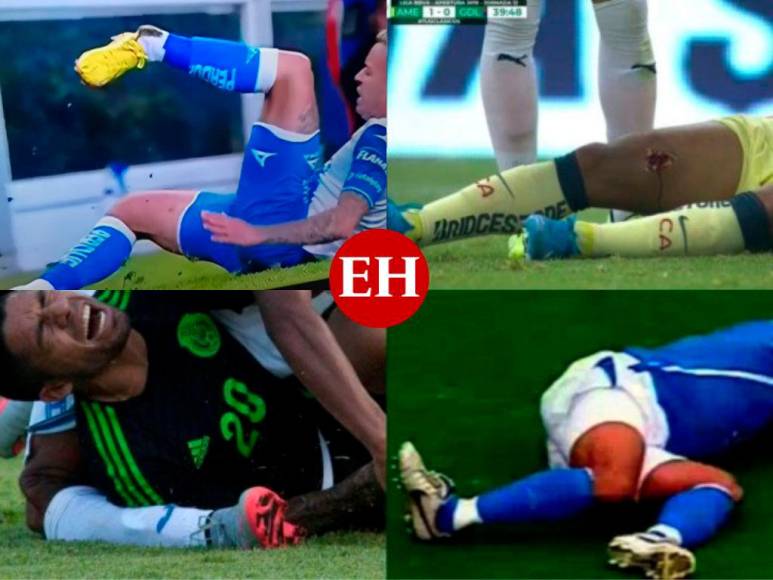 FOTOS: Ellos son los jugadores que han sufrido las peores lesiones en el fútbol