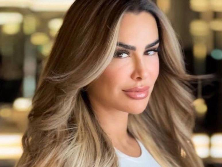 El drástico cambio en el rostro de Ninel Conde