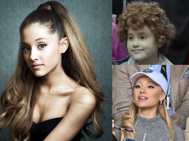 Evolución facial de Ariana Grande: la cantante reconoció haberse inyectado “una tonelada” de relleno de labios y bótox