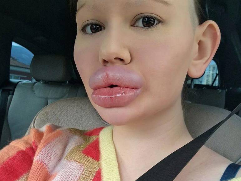 Andrea Ivanova, la mujer con los labios más grandes del mundo