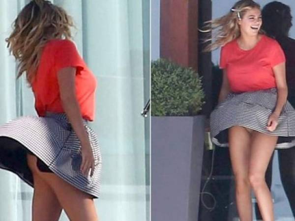 El incidente tuvo lugar durante una sesión de fotos en la casa de Kate Upton en Miami.