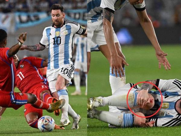 Lionel Messi volvió a ser víctima de una terrible entrada, esta vez durante el duelo amistoso entre Argentina y Panamá. Luego de la fuerte falta, la pulga se retorció del dolor en el césped del monumental. Este episodio hizo saltar las alarmas entre los presentes.