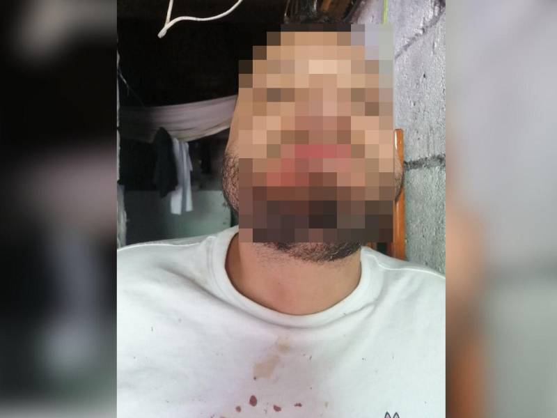 Los policías militaron propinaron una salvaje golpiza a uno de los privados de libertad.