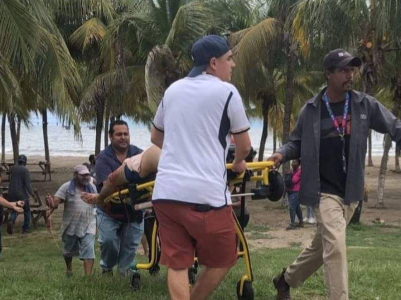 Hombre sufre feroz ataque de tiburón en la playa de Tela, Atlántida