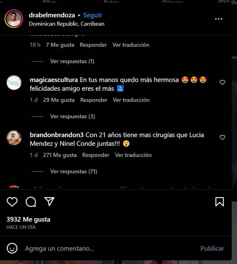 Los comentarios comparan a la famosa con otras que abusaron de las cirugías.